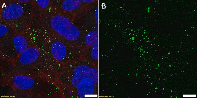 Anti-SPARC Antibody, clone 5N19 ZooMAb&#174; Rabbit Monoclonal recombinant, expressed in HEK 293 cells