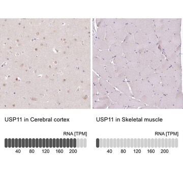 Anti-USP11 antibody produced in rabbit Prestige Antibodies&#174; Powered by Atlas Antibodies, affinity isolated antibody, buffered aqueous glycerol solution