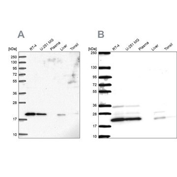 Anti-NDUFAF2 antibody produced in rabbit Prestige Antibodies&#174; Powered by Atlas Antibodies, affinity isolated antibody