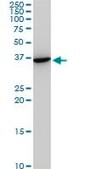 Monoclonal Anti-SNAI2 antibody produced in mouse clone 3C12, purified immunoglobulin, buffered aqueous solution