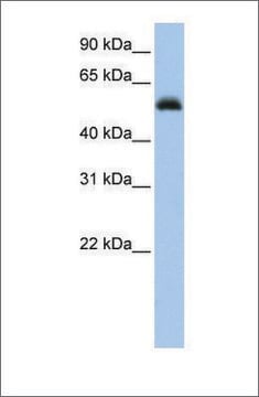 Anti-RUNX1 (ab2) antibody produced in rabbit affinity isolated antibody