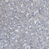 Anti-ARID5B antibody produced in rabbit Prestige Antibodies&#174; Powered by Atlas Antibodies, affinity isolated antibody, buffered aqueous glycerol solution