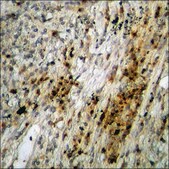 Anti-phospho-HDAC3 (pSer424) antibody produced in rabbit affinity isolated antibody