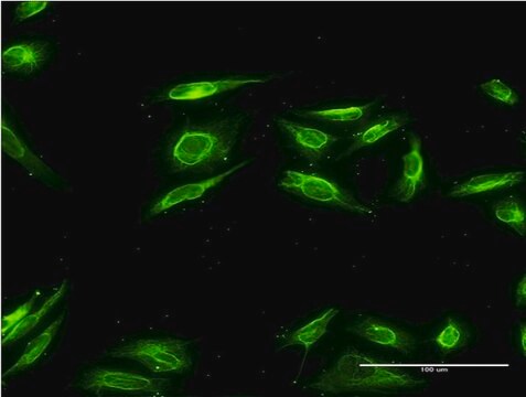 Monoclonal Anti-AKR1B10 antibody produced in mouse clone 2B3, purified immunoglobulin, buffered aqueous solution