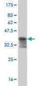 ANTI-MAPKAPK2 antibody produced in mouse clone 1F9, purified immunoglobulin, buffered aqueous solution