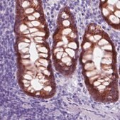 Monoclonal Anti-CA12 antibody produced in mouse Prestige Antibodies&#174; Powered by Atlas Antibodies, clone CL0280, purified immunoglobulin, buffered aqueous glycerol solution