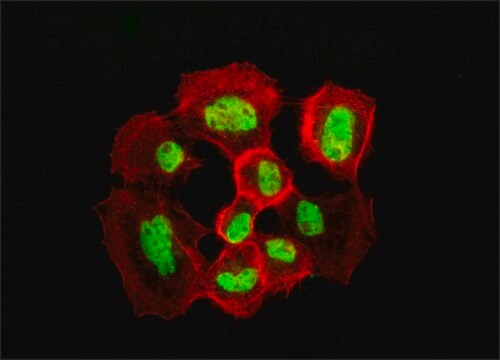 Anti-SGK antibody produced in rabbit buffered aqueous solution, IgG fraction of antiserum