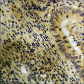 Anti-phospho-Catenin-&#946; (pTyr489) antibody produced in rabbit affinity isolated antibody