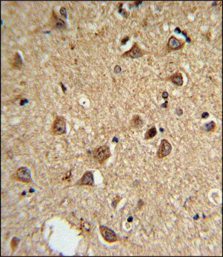 ANTI-DIO2 (CENTER) antibody produced in rabbit IgG fraction of antiserum, buffered aqueous solution