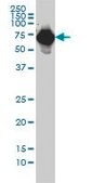 Monoclonal Anti-AFP antibody produced in mouse clone 1G7, purified immunoglobulin, buffered aqueous solution