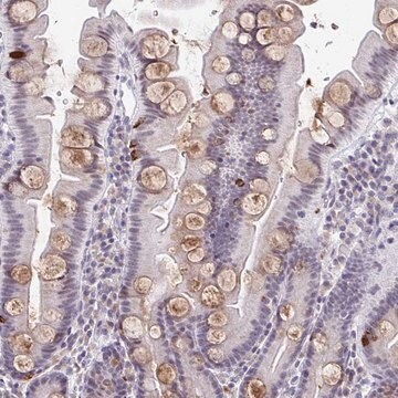 Anti-WDR72 antibody produced in rabbit Prestige Antibodies&#174; Powered by Atlas Antibodies, affinity isolated antibody, buffered aqueous glycerol solution