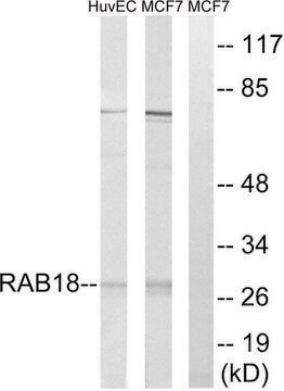 Anti-RAB18 antibody produced in rabbit affinity isolated antibody