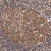 Anti-WDR77 antibody produced in rabbit Prestige Antibodies&#174; Powered by Atlas Antibodies, affinity isolated antibody, buffered aqueous glycerol solution, ab3