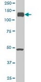 Monoclonal Anti-EPHA2 antibody produced in mouse clone 1E3, purified immunoglobulin, buffered aqueous solution