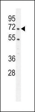 ANTI-PRMT4 (CENTER) antibody produced in rabbit affinity isolated antibody, buffered aqueous solution