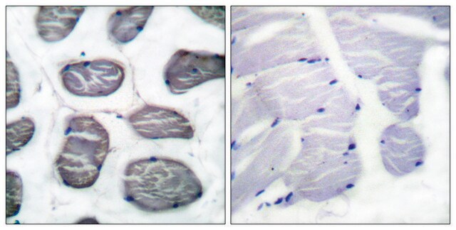 Anti-ACTIN-&#945;-1 antibody produced in rabbit affinity isolated antibody