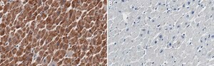 Anti-NDUFB8 Antibody, clone 1E7 ZooMAb&#174; Rabbit Monoclonal recombinant, expressed in HEK 293 cells