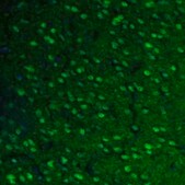 Anti-FH antibody produced in rabbit affinity isolated antibody, buffered aqueous glycerol solution, ab1