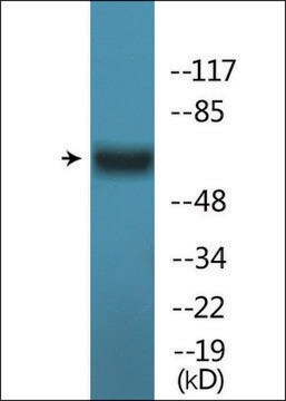 Anti-phospho-Estrogen Receptor-&#945; (pSer167) antibody produced in rabbit affinity isolated antibody