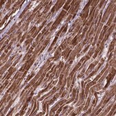 Anti-OXCT1 antibody produced in rabbit Prestige Antibodies&#174; Powered by Atlas Antibodies, affinity isolated antibody, buffered aqueous glycerol solution