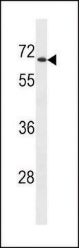 ANTI-UGT2B28 (CENTER) antibody produced in rabbit affinity isolated antibody, buffered aqueous solution