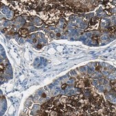 Anti-MUC4 antibody produced in rabbit Prestige Antibodies&#174; Powered by Atlas Antibodies, affinity isolated antibody, buffered aqueous glycerol solution