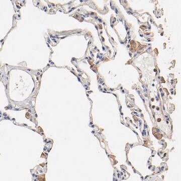 Anti-TAGLN2 antibody produced in rabbit Prestige Antibodies&#174; Powered by Atlas Antibodies, affinity isolated antibody, buffered aqueous glycerol solution