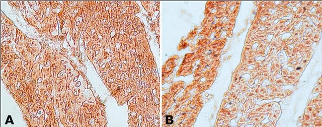 Anti-Guanylyl Cyclase &#945;1 antibody produced in rabbit IgG fraction of antiserum, buffered aqueous solution