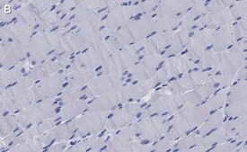 Anti-MYH1 Antibody, clone 1E15 , ZooMAb&#174; Rabbit Monoclonal recombinant, expressed in HEK 293 cells