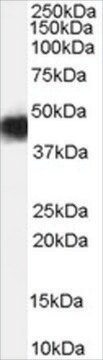 Anti-CCM2 antibody produced in goat affinity isolated antibody, buffered aqueous solution