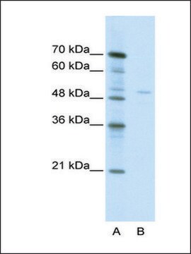 Anti-TRIM38 (AB1) antibody produced in rabbit affinity isolated antibody