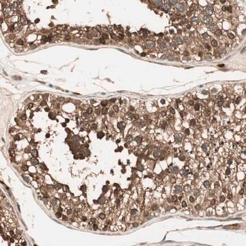Anti-CNOT4 antibody produced in rabbit affinity isolated antibody, buffered aqueous glycerol solution