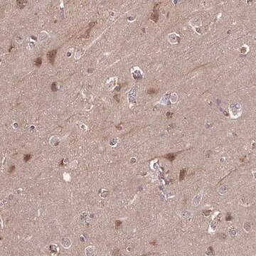 Anti-TIGAR antibody produced in rabbit Prestige Antibodies&#174; Powered by Atlas Antibodies, affinity isolated antibody, buffered aqueous glycerol solution