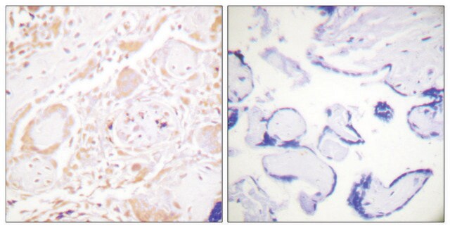 Anti-GATA3 antibody produced in rabbit affinity isolated antibody