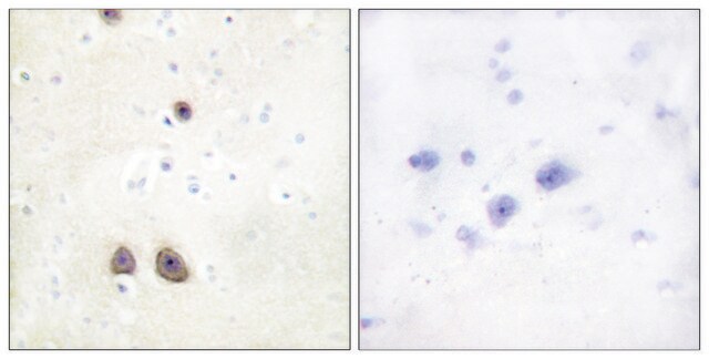 Anti-Caper antibody produced in rabbit affinity isolated antibody