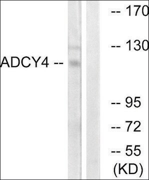 Anti-ADCY4 antibody produced in rabbit affinity isolated antibody