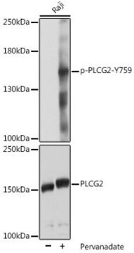 Anti-Phospho-PLCG2-Y759 antibody produced in rabbit