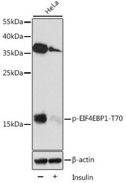 Anti-Phospho-EIF4EBP1-T70 antibody produced in rabbit