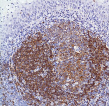 Anti-CD22 antibody, Rabbit monoclonal recombinant, expressed in proprietary host, clone SP104, affinity isolated antibody