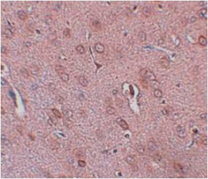 Anti-TRESK Antibody from rabbit, purified by affinity chromatography