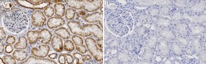 Anti-TRPV4 Antibody, clone 1G10-L2 ZooMAb&#174; Rabbit Monoclonal recombinant, expressed in HEK 293 cells