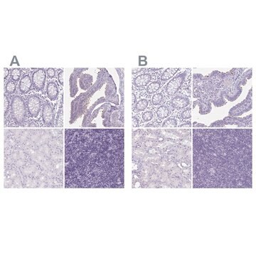 Anti-ENKUR antibody produced in rabbit Prestige Antibodies&#174; Powered by Atlas Antibodies, affinity isolated antibody, buffered aqueous glycerol solution