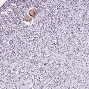 Anti-TTLL3 antibody produced in rabbit Prestige Antibodies&#174; Powered by Atlas Antibodies, affinity isolated antibody, buffered aqueous glycerol solution
