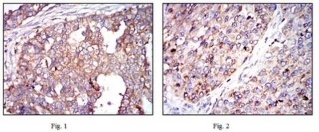 Anti-G6PD Antibody, clone 2H7 ascites fluid, clone 2H7, from mouse