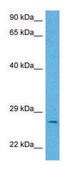 Anti-PDYN antibody produced in rabbit HRP affinity isolated antibody