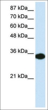 Anti-HOXD4 (AB1) antibody produced in rabbit affinity isolated antibody