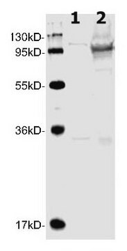 Anti-Adenovirus 5 L4-100K