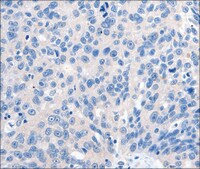 Anti-GRIN2D antibody produced in rabbit affinity isolated antibody