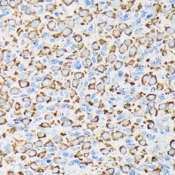 Anti-NDUFS4 antibody produced in rabbit