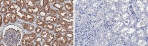 Anti-GSK3&#945; Antibody, clone 2J11 ZooMAb&#174; Rabbit Monoclonal recombinant, expressed in HEK 293 cells